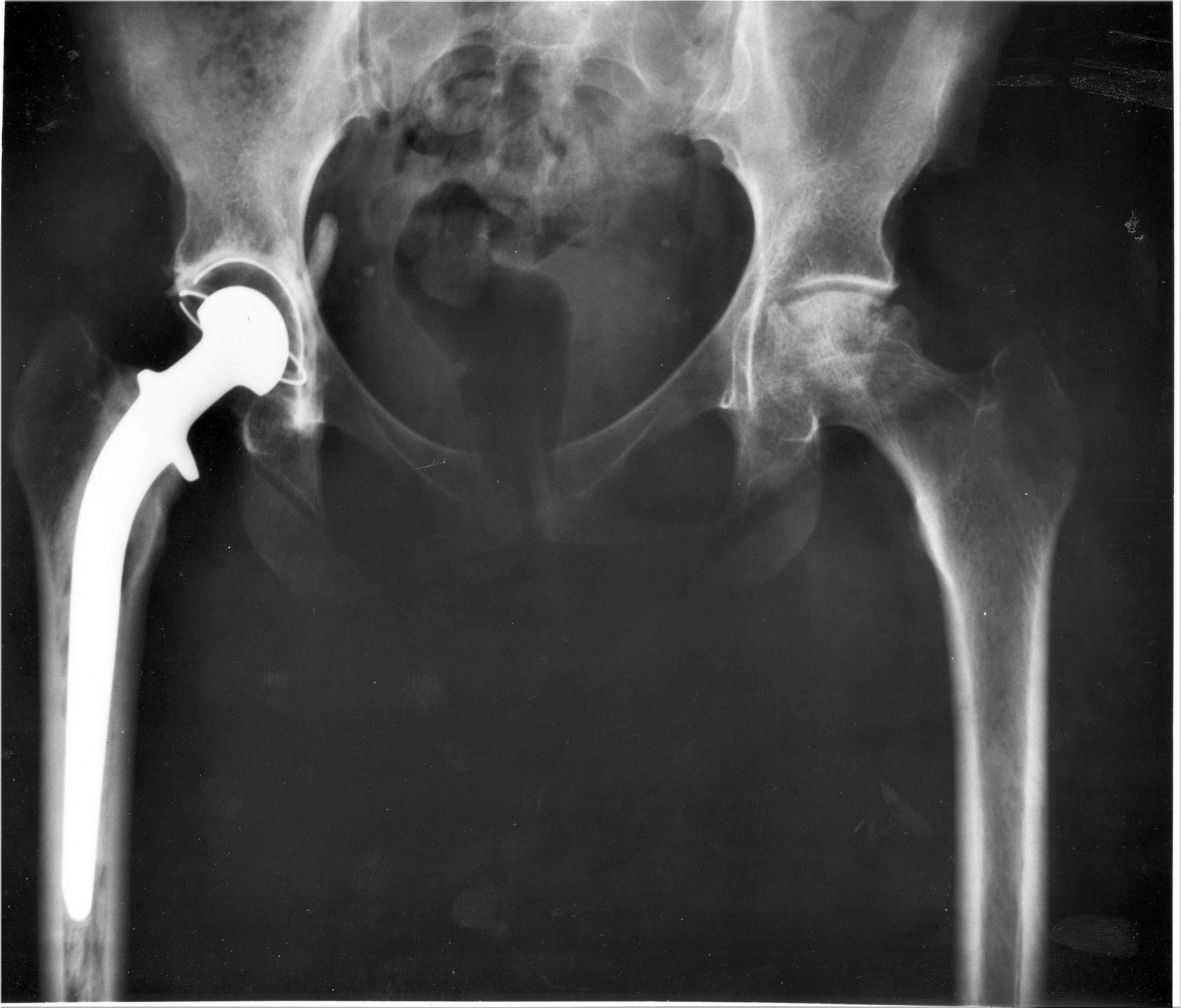 Hip dysplasia in cats